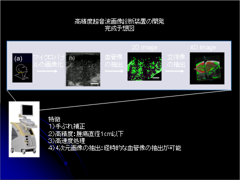 高精度超音波画像診断装置の開発