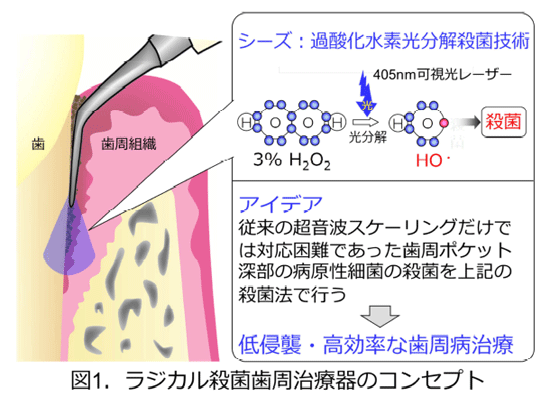 図1：ラジカル殺菌歯周治療器のコンセプト